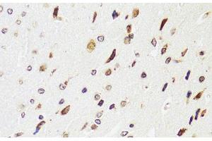 Immunohistochemistry of paraffin-embedded Rat brain using EDF1 Polyclonal Antibody at dilution of 1:100 (40x lens). (EDF1 Antikörper)