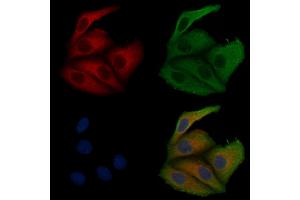 ABIN6257498 and ABIN6275600 staining Hela cells by IF/ICC. (Sorting Nexin 1 Antikörper  (Internal Region))