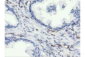 Immunohistochemical staining of paraffin-embedded Human liver tissue using anti-ARHGAP25 mouse monoclonal antibody. (ARHGAP25 Antikörper)