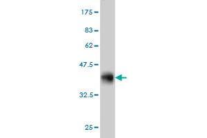 Western Blot detection against Immunogen (36. (GRK6 Antikörper  (AA 71-170))