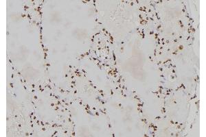 ABIN6273460 at 1/100 staining Human lung tissue by IHC-P. (CENPL Antikörper  (Internal Region))
