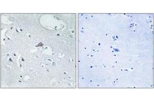 Immunohistochemistry analysis of paraffin-embedded human brain tissue, using OPRM1 Antibody. (Mu Opioid Receptor 1 Antikörper  (AA 21-70))
