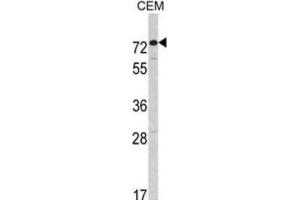 Western Blotting (WB) image for anti-Anti-Mullerian Hormone Receptor, Type II (AMHR2) antibody (ABIN3003000)