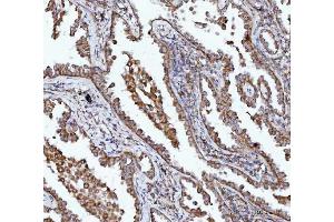 IHC analysis of BBS9 using anti-BBS9 antibody (ABIN7601518). (BBS9 Antikörper  (AA 37-793))