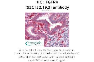 Image no. 2 for anti-Fibroblast Growth Factor Receptor 4 (FGFR4) antibody (ABIN2851987) (FGFR4 Antikörper)