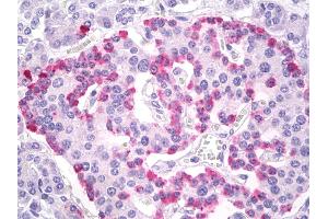 Anti-Glucagon antibody IHC of human pancreas, islets of Langerhans. (Glucagon Antikörper  (AA 25-54))