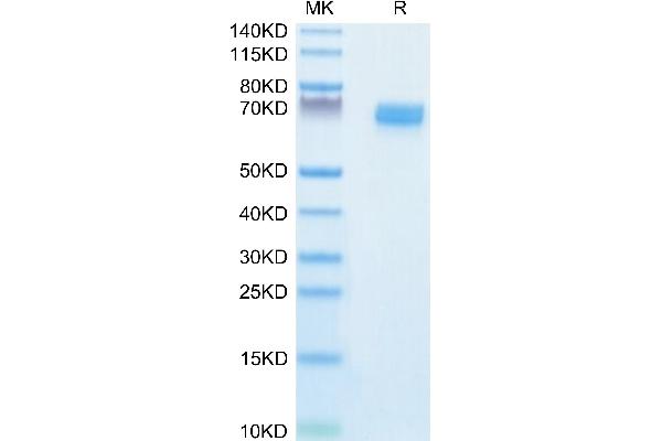 EPH Receptor B2 Protein (EPHB2) (AA 19-543) (His tag)