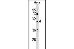 ALG2 Antibody (Center) (ABIN1538197 and ABIN2848872) western blot analysis in Hela cell line lysates (35 μg/lane). (ALG2 Antikörper  (AA 254-282))