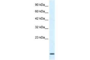 Western Blotting (WB) image for anti-Homeobox A1 (HOXA1) antibody (ABIN2461047) (HOXA1 Antikörper)