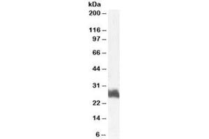 Western blot testing of human bone marrow lysate with FRA1 antibody at 1ug/ml. (FOSL1 Antikörper)