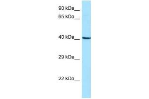 WB Suggested Anti-ARPC1B Antibody Titration: 1. (ARPC1B Antikörper  (Middle Region))