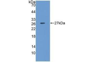 Detection of Recombinant CLU, Porcine using Polyclonal Antibody to Clusterin (CLU) (Clusterin Antikörper  (AA 229-446))