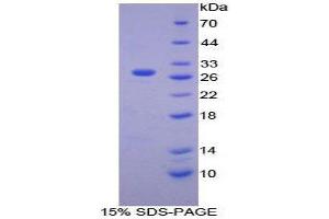 SDS-PAGE (SDS) image for Calcium Independent Phospholipase A2 (PNPLA2) (AA 481-702) protein (His tag) (ABIN1879482)