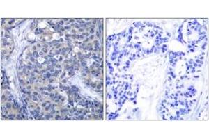 Immunohistochemistry (IHC) image for anti-zeta-Chain (TCR) Associated Protein Kinase 70kDa (ZAP70) (AA 286-335) antibody (ABIN2889082) (ZAP70 Antikörper  (AA 286-335))
