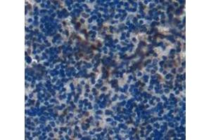 Used in DAB staining on fromalin fixed paraffin- embedded spleen tissue