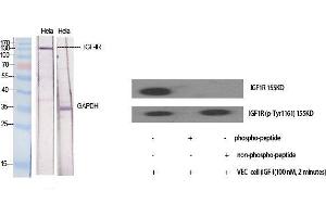 Western Blot (WB) analysis of specific cells using IGF-IR Polyclonal Antibody. (IGF1R Antikörper  (Ser1026))