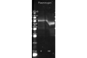 Goat anti Plasminogen antibody ( was used to detect Plasminogen under reducing (R) and non-reducing (NR) conditions.