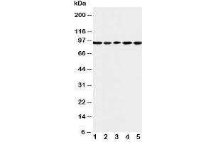 Western blot testing of MCM6 antibody and Lane 1:  U87;  2: COLO320;  3: HeLa;  4: MCF-7;  5: Jurkat cell lysate (MCM6 Antikörper  (Middle Region))