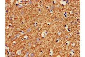 IHC image of ABIN7160401 diluted at 1:400 and staining in paraffin-embedded human brain tissue performed on a Leica BondTM system. (MBP Antikörper  (AA 1-197))