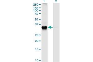 Western Blot analysis of STX4 expression in transfected 293T cell line by STX4A monoclonal antibody (M04), clone 6D1. (Syntaxin 4 Antikörper  (AA 19-119))