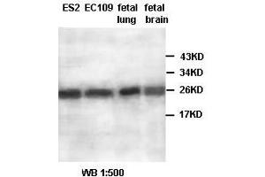 Image no. 2 for anti-Aldo-Keto Reductase Family 1, Member A1 (Aldehyde Reductase) (AKR1A1) antibody (ABIN791183) (AKR1A1 Antikörper)