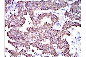 Immunohistochemistry (IHC) image for anti-Keratin 5 (KRT5) (AA 316-590) antibody (ABIN1845567) (Cytokeratin 5 Antikörper  (AA 316-590))