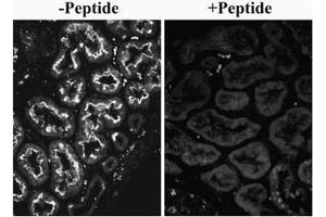 AP32082PU-N SLC26A6 Antibody overnight staining of paraffin embedded Human Kidney at 0. (SLC26A6 Antikörper  (Internal Region))