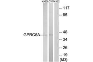 Western Blotting (WB) image for anti-G Protein-Coupled Receptor, Family C, Group 5, Member A (GPRC5A) (AA 140-189) antibody (ABIN2891081) (GPRC5A Antikörper  (AA 140-189))