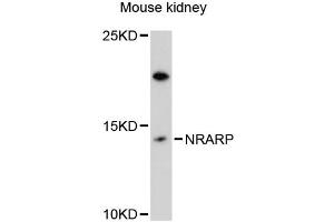 Western blot analysis of extracts of mouse kidney, using NRARP antibody (ABIN6293849) at 1:3000 dilution. (NRARP Antikörper)