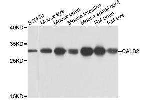 Western blot analysis of extracts of various cells, using CALB2 antibody. (Calretinin Antikörper)
