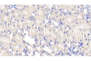 Detection of DLAT in Mouse Kidney Tissue using Polyclonal Antibody to Dihydrolipoyl Transacetylase (DLAT) (DLAT Antikörper  (AA 368-626))