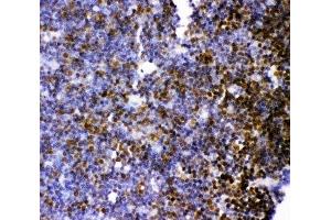 IHC-P: MCAK antibody testing of rat thymus tissue (KIF2C Antikörper  (AA 531-725))