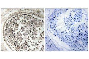 Immunohistochemistry (IHC) image for anti-Mitochondrial Ribosomal Protein S5 (MRPS5) (C-Term) antibody (ABIN1851568)