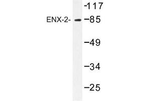 Image no. 1 for anti-Enhancer of Zeste Homolog 1 (EZH1) antibody (ABIN272247) (EZH1 Antikörper)
