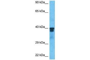 Host:  Rabbit  Target Name:  PAX6  Sample Type:  786-0 Whole Cell lysates  Antibody Dilution:  1. (PAX6 Antikörper  (C-Term))