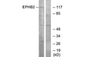 Western blot analysis of extracts from Jurkat cells, using EPHB2 Antibody. (EPH Receptor B2 Antikörper  (AA 991-1040))