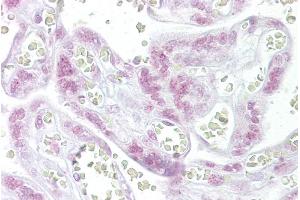 Immunohistochemistry with Placenta tissue at an antibody concentration of 10µg/ml using anti-CHEK2 antibody (ARP30290_P050) (CHEK2 Antikörper  (N-Term))
