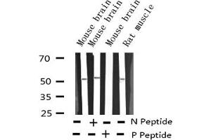 Western blot analysis of Phospho-ATF2 (Ser62 or 44) expression in various lysates (ATF2 Antikörper  (pSer44, pSer62))