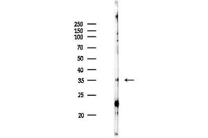 anti-Abhydrolase Domain Containing 6 (ABHD6) (Internal Region) antibody