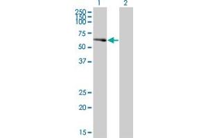 Western Blot analysis of PCTK2 expression in transfected 293T cell line by PCTK2 polyclonal antibody (A01).