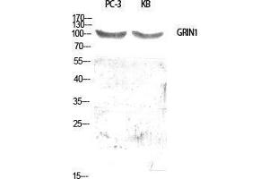 Western Blot (WB) analysis of specific cells using GRIN1 Polyclonal Antibody. (GRIN1/NMDAR1 Antikörper  (Internal Region))