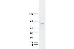 Validation with Western Blot (CCT3 Protein (Transcript Variant 2) (Myc-DYKDDDDK Tag))