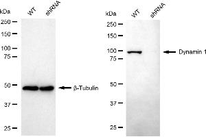Western blotting analysis using dynamin 1 antibody (ABIN7798397). (Rekombinanter Dynamin 1 Antikörper)