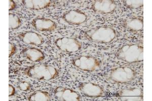 Immunoperoxidase of monoclonal antibody to CSE1L on formalin-fixed paraffin-embedded human colon. (Exportin 2 Antikörper  (AA 872-971))