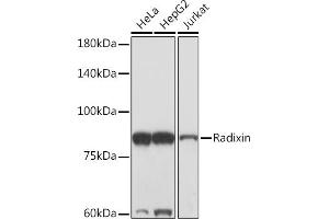 Western blot analysis of extracts of various cell lines, using Radixin Rabbit mAb (ABIN7269833) at 1:1000 dilution. (Radixin Antikörper)