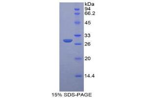 SDS-PAGE (SDS) image for Insulin-Like Growth Factor 2 Receptor (IGF2R) (AA 1146-1363) protein (His tag) (ABIN1878976)