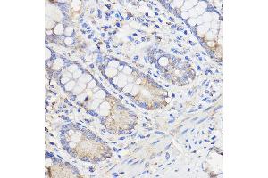 Immunohistochemistry of paraffin-embedded Human colon using WBSCR27 Rabbit pAb (ABIN7271366) at dilution of 1:50 (40x lens). (WBSCR27 Antikörper  (AA 1-245))