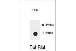 Dot Blot (DB) image for anti-Phosphinothricin N-Acetyltransferase (BAR2) (pSer261) antibody (ABIN3001865) (BAR2 Antikörper  (pSer261))
