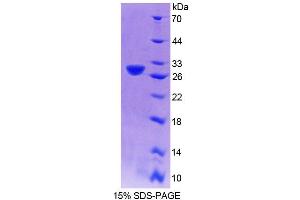 SDS-PAGE (SDS) image for Centromere Protein J (CENPJ) (AA 1-204) protein (His tag) (ABIN6240033) (CENPJ Protein (AA 1-204) (His tag))