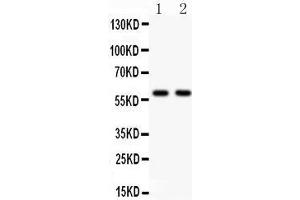 Anti- KAT13A antibody, Western blotting All lanes: Anti KAT13A  at 0. (NCOA1 Antikörper  (AA 614-826))